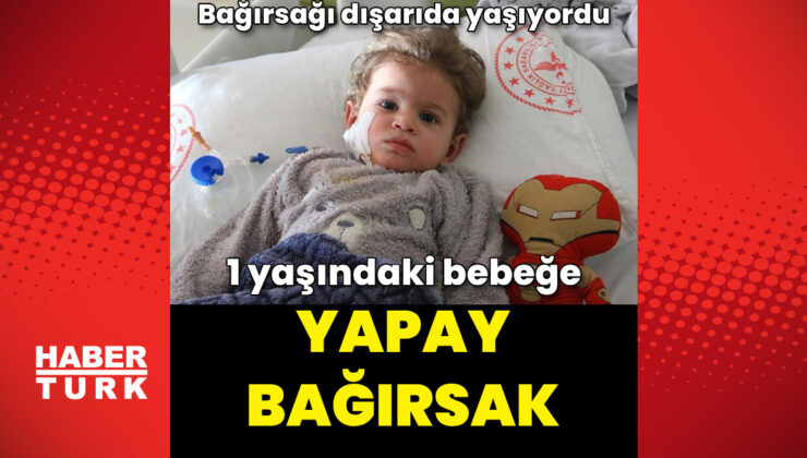 Kalın bağırsağı dışarıda yaşayan bebek yapay bağırsakla sağlığına kavuştu